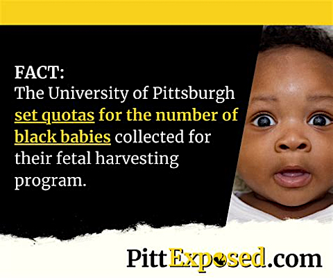 image University of Pittsburg fetal harvesting