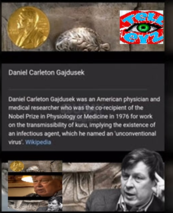 King Charles  !!!! 'Dying of Kuru' After Decades of Child Meat Banquets  !!!!