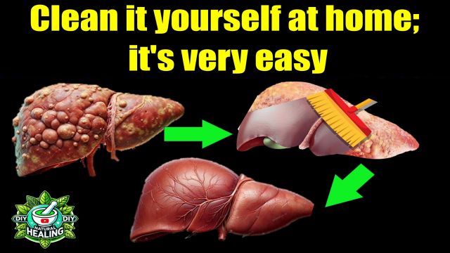 6 FOODS THAT NATURALLY CLEANSE THE LIVER #diy