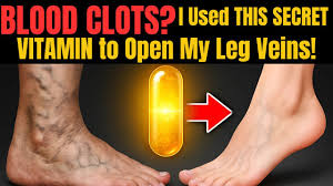 This Vitamin Dissolves Blood Clots in Your Legs – Seniors Over 60 Must Watch!