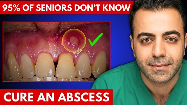Why Can a Tooth Abscess Turn DEADLY Within 24 HOURS? Dentist Reveals 5 CRITICAL Signs & Treatment